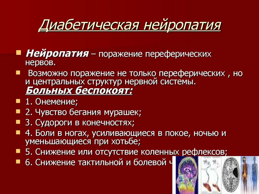 Диабетическая нейропатия. Диабетическая нейропатия лекарства. Полинейропатия диабетического типа. Диабетическая полинейропатия, алкогольная полинейропатия.. Нейропатия нижних конечностей ног