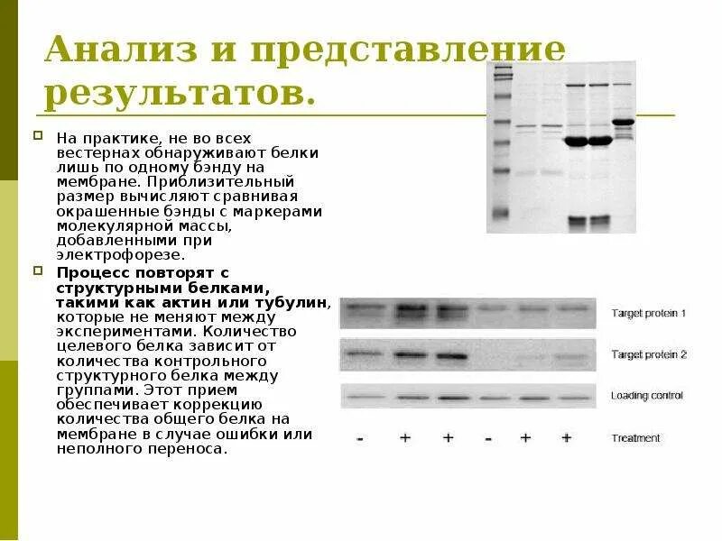 Иммуноблоттинг вестерн-блоттинг. Антинуклеарные антитела иммуноблот. Вестерн блоттинг анализ результатов. Иммуноблот антинуклеарных антител расшифровка.