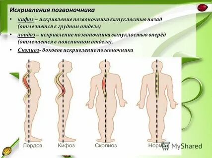 Сколиоз биология