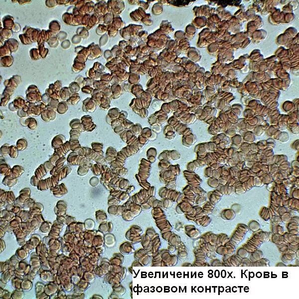 При каком увеличении можно увидеть