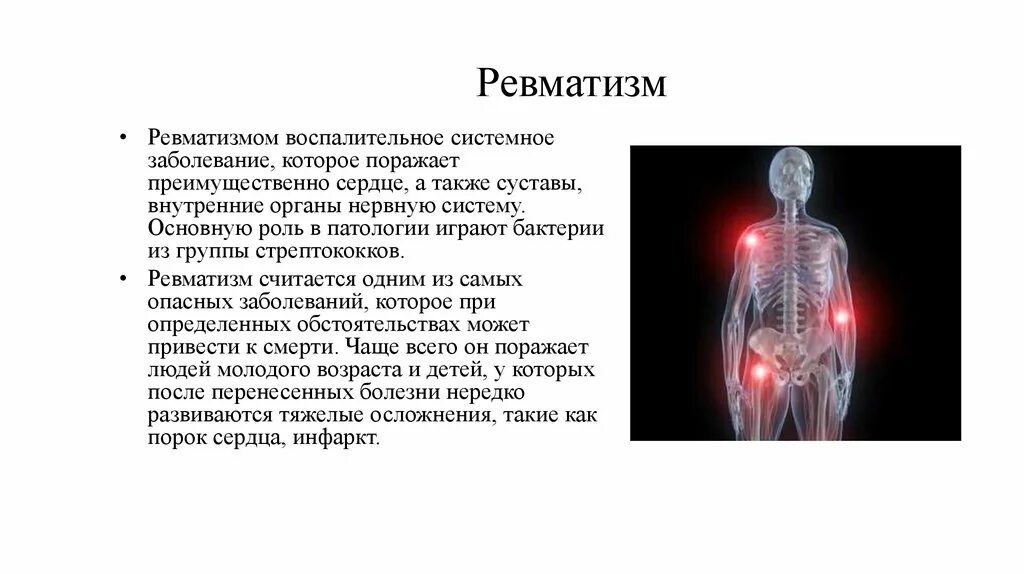 Ревматизм это простыми словами что за болезнь. Ревматическое поражение нервной системы. Ревматизм жалобы.