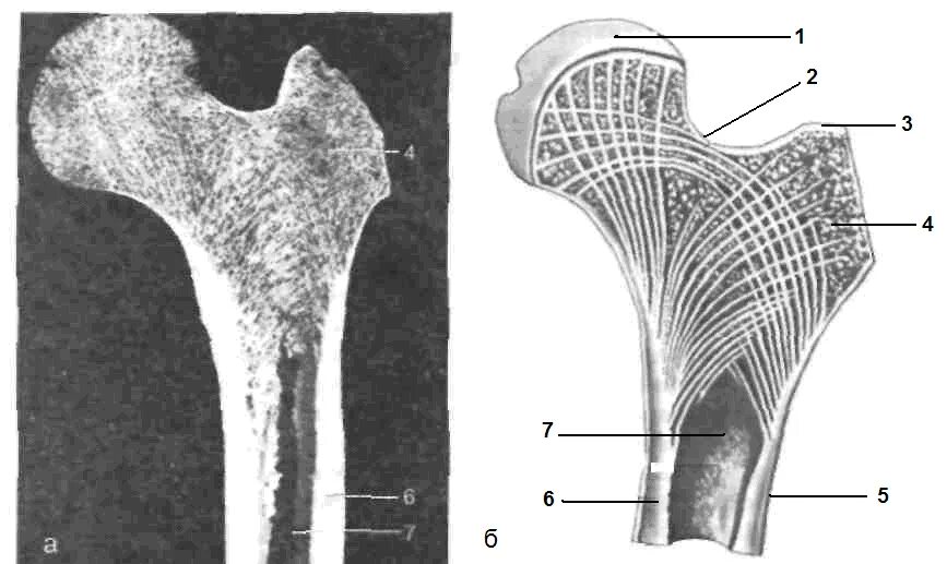 Пятка состав. Костная структура головки бедренной кости. Бедренная кость метафиз. Строение головки бедренной кости. Строение бедренной кости на распиле.