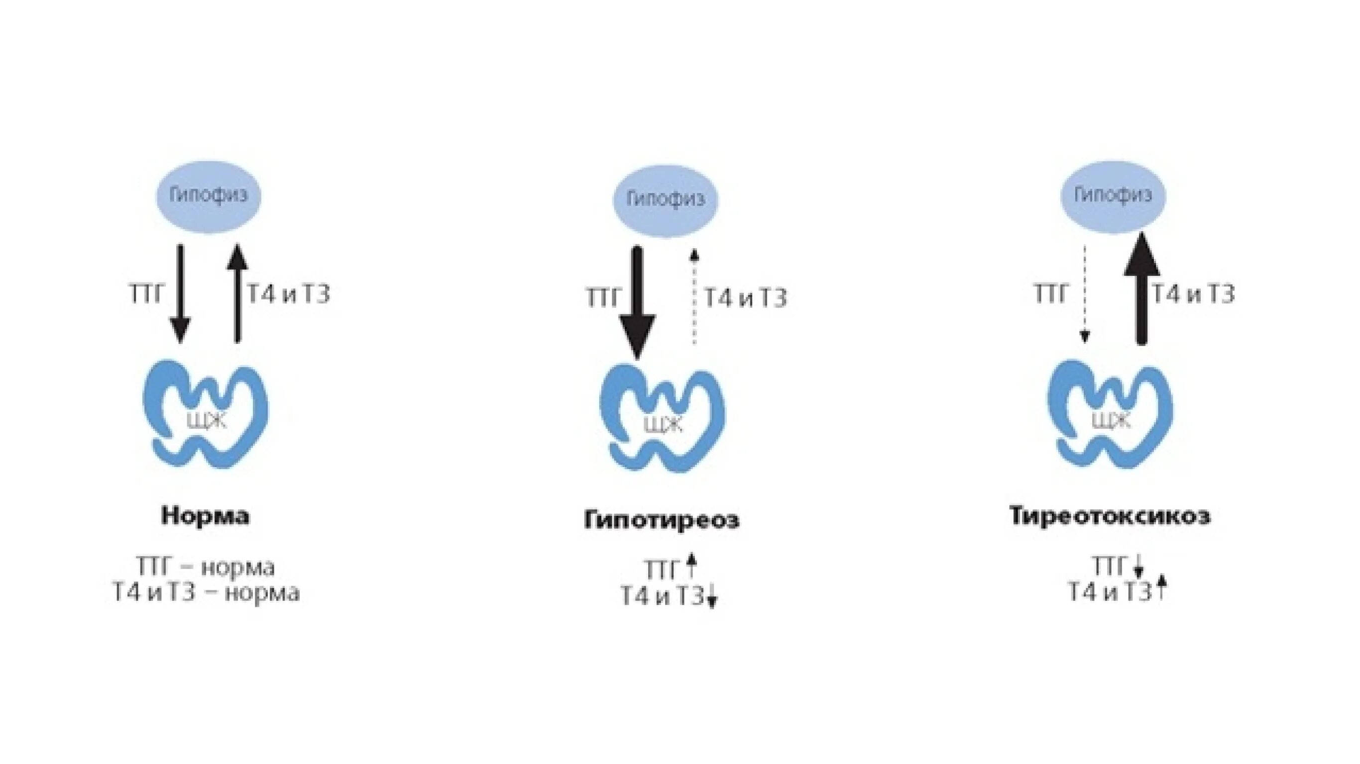 Повышенный тиреотропный гормон у женщин причины. Тиреотропный гормон. ТТГ. Высокий ТТГ. Схема повышения ТТГ.