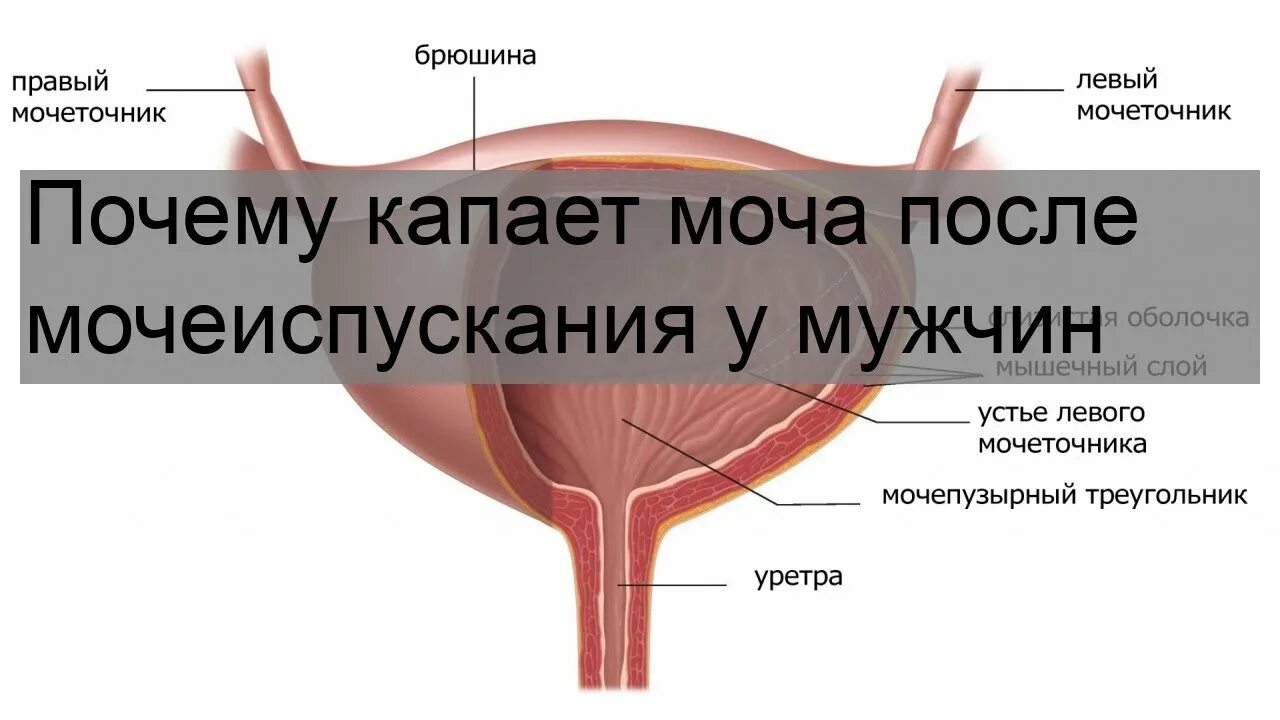 Капает моча у мужчин. Подтекание мочи после мочеиспускания. Воспаление мочевого пузыря. Мочепузырный треугольник.