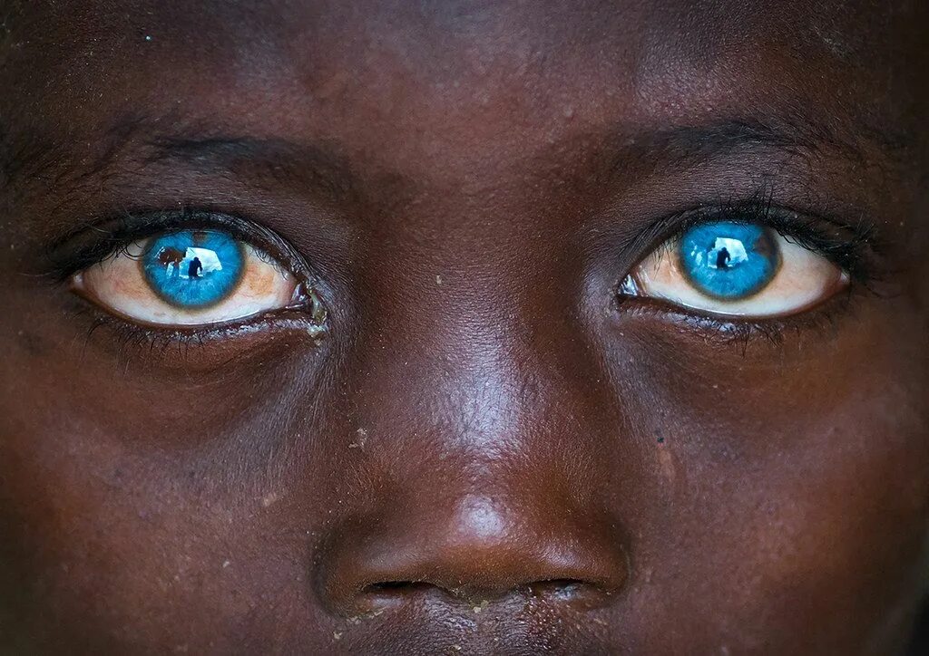 Голубоглазые родственники. Сапфировые глаза. Необычные глаза. Красивые голубые глаза. Люди с необычным цветом глаз.