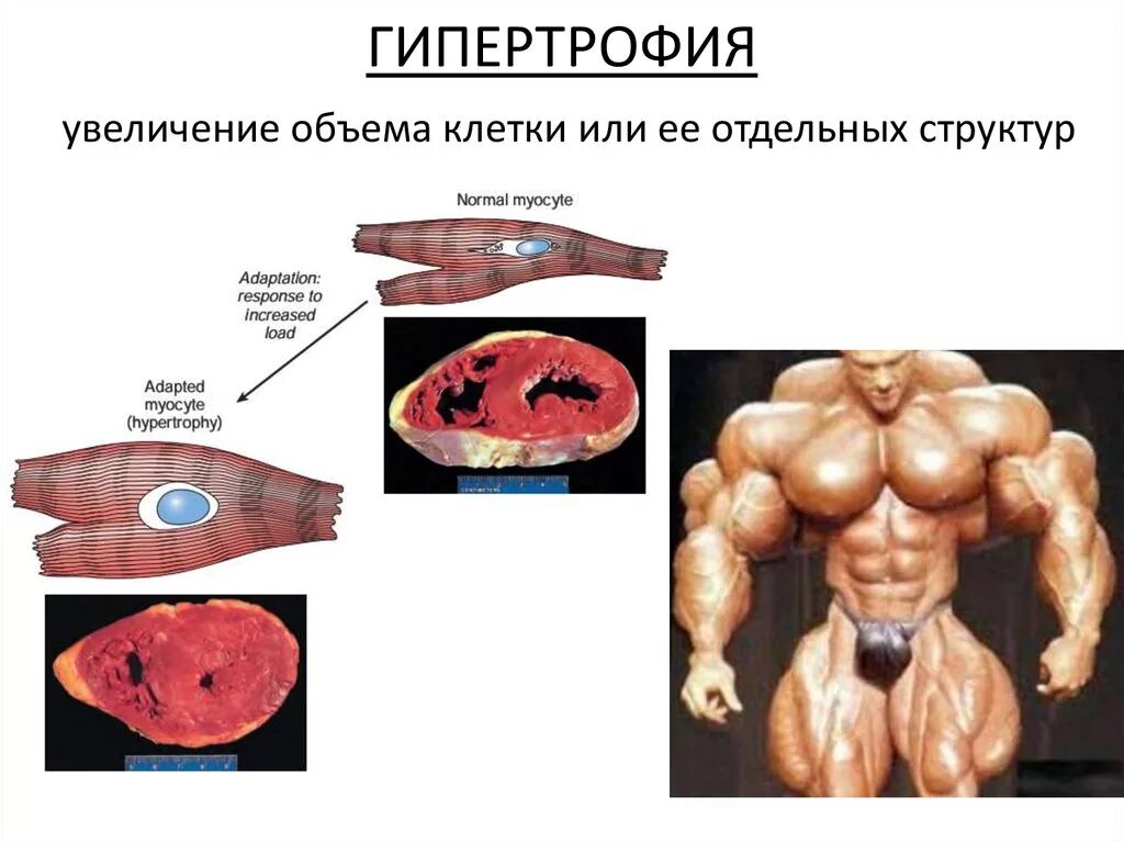 Гипертрофия что это. Гипертрофия мышц. Гипертрофия презентация. Истинная гипертрофия мышц.