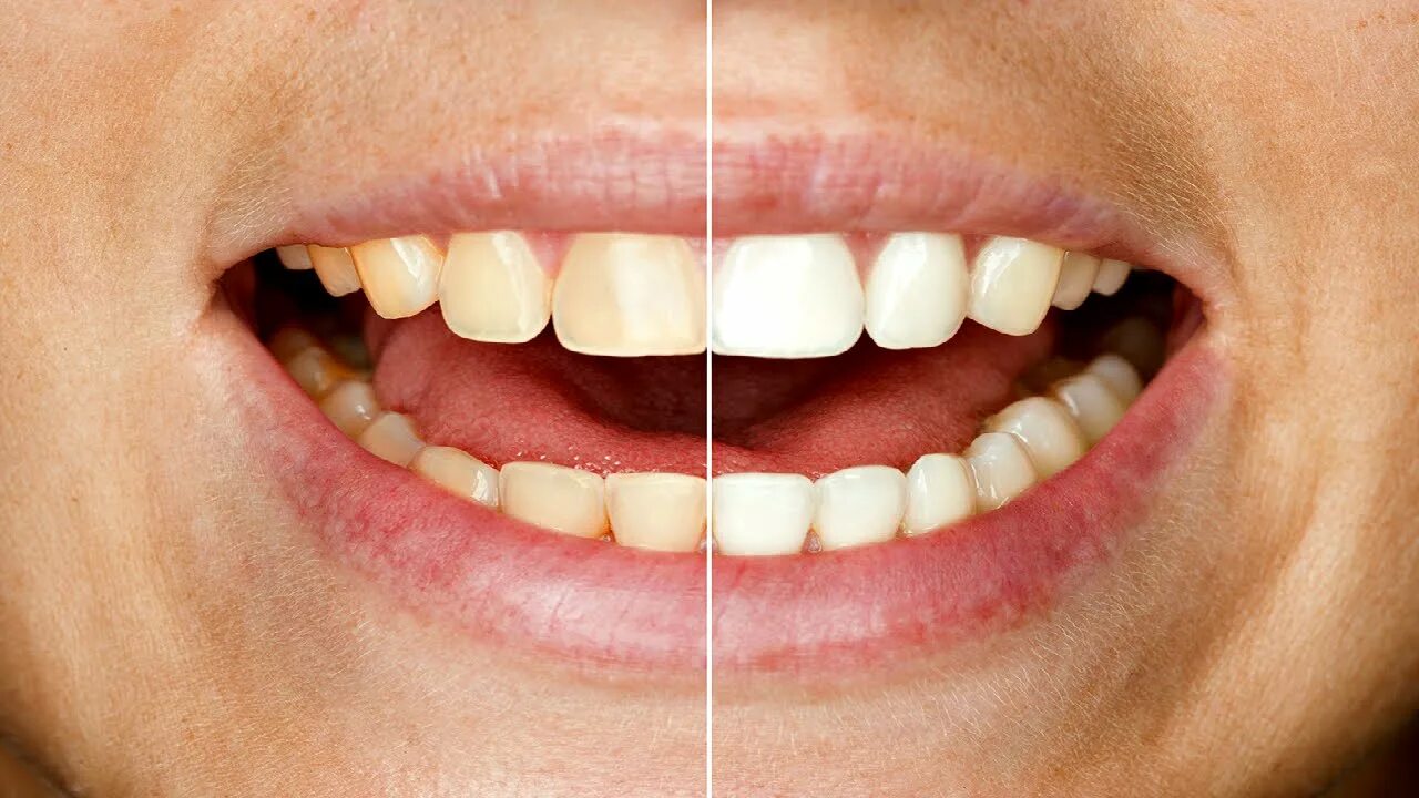 Скажи зуб. Здоровые зубы открытый рот. Ровные зубы открытый рот. Открытый рот зубы женщины.