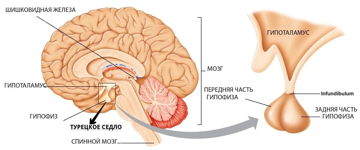 Формирующееся турецкое седло в головном мозге