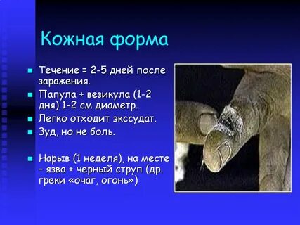 Струпья на коже кроссворд