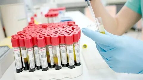 Биоматериал для лабораторного исследования