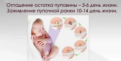 Уход за пупочной ранкой