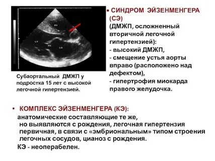 Дмжп у новорожденного