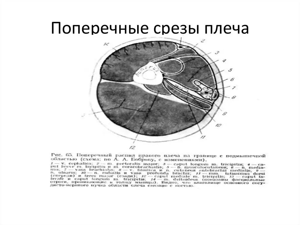 Данные поперечного среза. Поперечные срезы плеча топографическая анатомия. Поперечный срез плеча в средней трети. Поперечные распилы плеча топографическая анатомия. Срез предплечья топографическая.