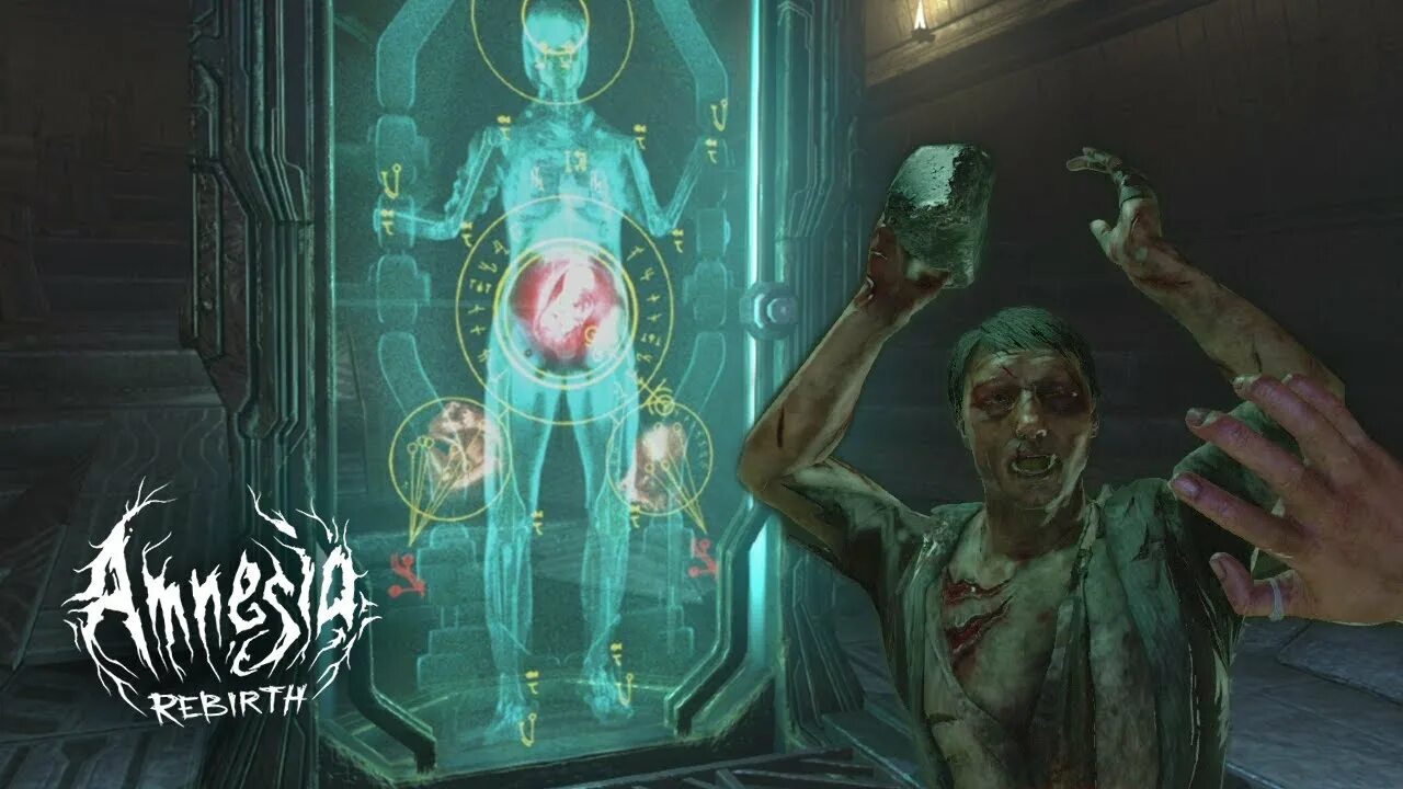 Amnezia self hosted. Amnezia self hosted