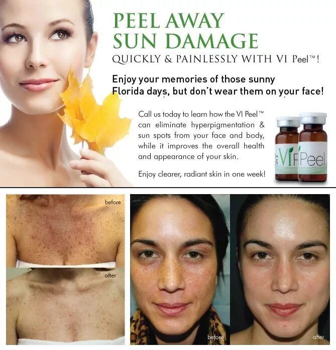 Желтый пилинг цена skinlift ru. Миндальный пилинг New Peel. Желтый пилинг Нью пил. Желтый пилинг New Peel.