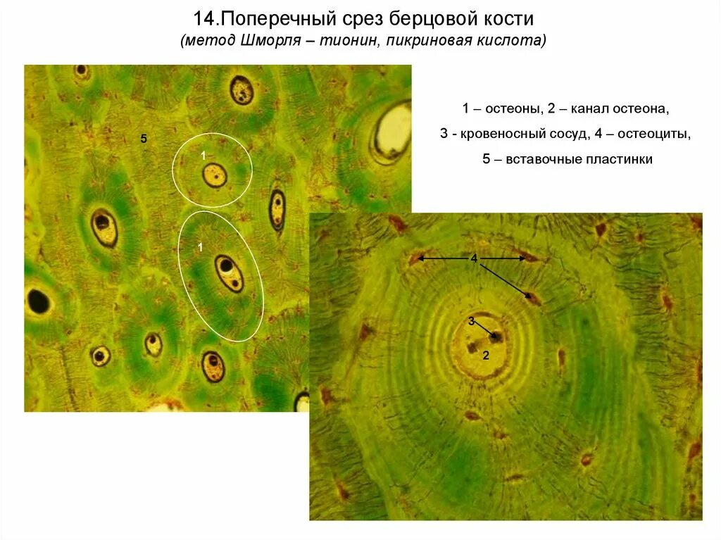 Срез кости. Пластинчатая костная ткань. Поперечный срез кости гистология. Пластинчатая костная ткань продольный разрез. Пластинчатая костная ткань поперечный срез трубчатой кости.
