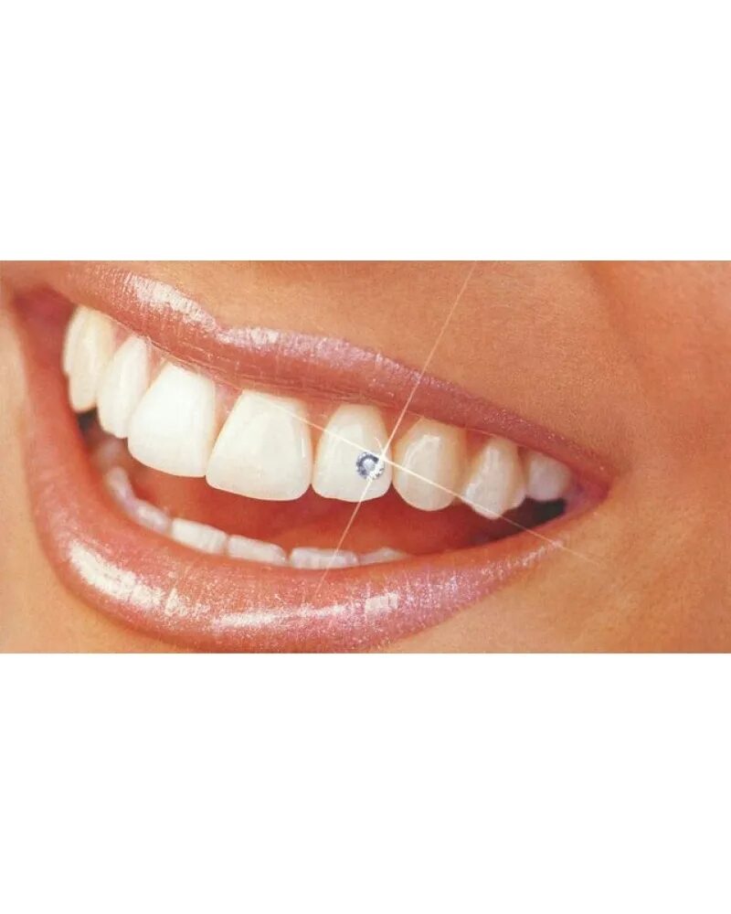 сделать скайсы на зубы