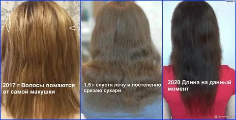 Отрасли волосы или отросли волосы
