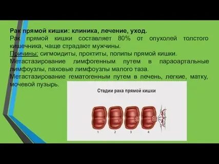 Лечение проктита прямой кишки препараты