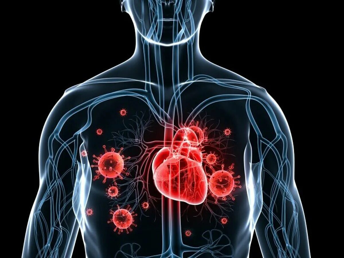 Осложнение на сердце после. Инфекционные заболевания сердца. Воспалительные заболевания сердца. Поражение сердечно-сосудистой системы.