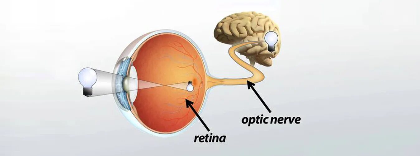 Optic nerve. Optic nerve myelinated. Место откуда выходит зрительный нерв