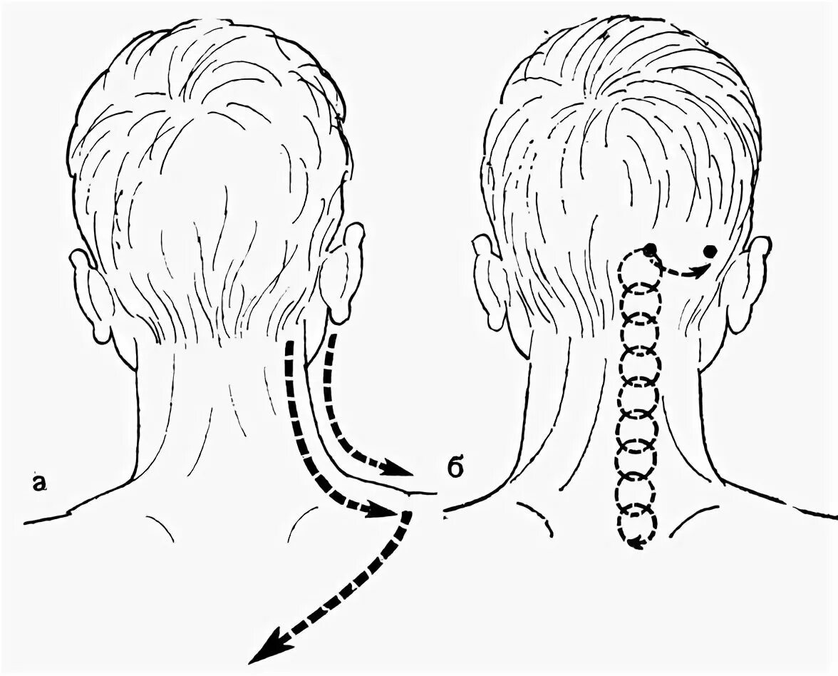 Линия затылка. Схема массаж шейно-воротниковой зоны. Техника массажа шейно-воротниковой зоны. Шейно-воротниковая зона массаж схема массажа. Схема шейно воротниковой зоны.