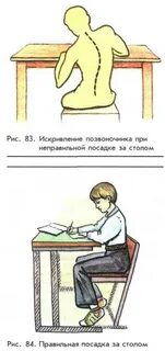 Посадка головы