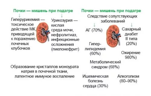 Почки дают температуру. Подагра поражение почек. Поражение почек при подагре. Почечная гиперурикемия.