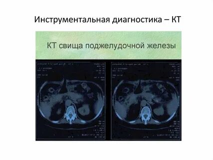 Диагностика поджелудочной железы