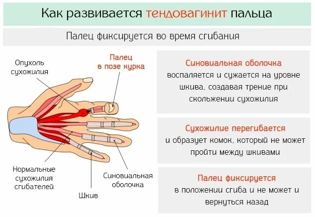 Дергается предплечье