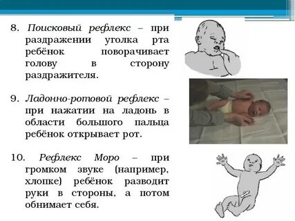 Ладонно ротовой рефлекс