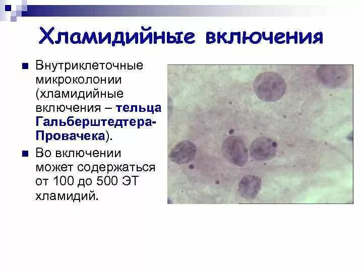 Хламидии Романовскому Гимзе. Окраска хламидий по Романовскому Гимзе. Хламидии препарат микробиология. Хламидиоз окраска по Романовскому. Пятерка хламидия