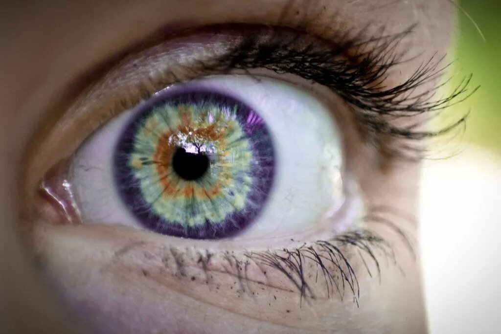 Разнообразие глаз. Радужная оболочка гетерохромия. Фиолетовая гетерохромия. Кольцевая гетерохромия глаз. Гетерохромия Радужки глаз.
