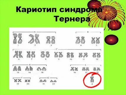 Уменьшение числа отдельных хромосом в кариотипе