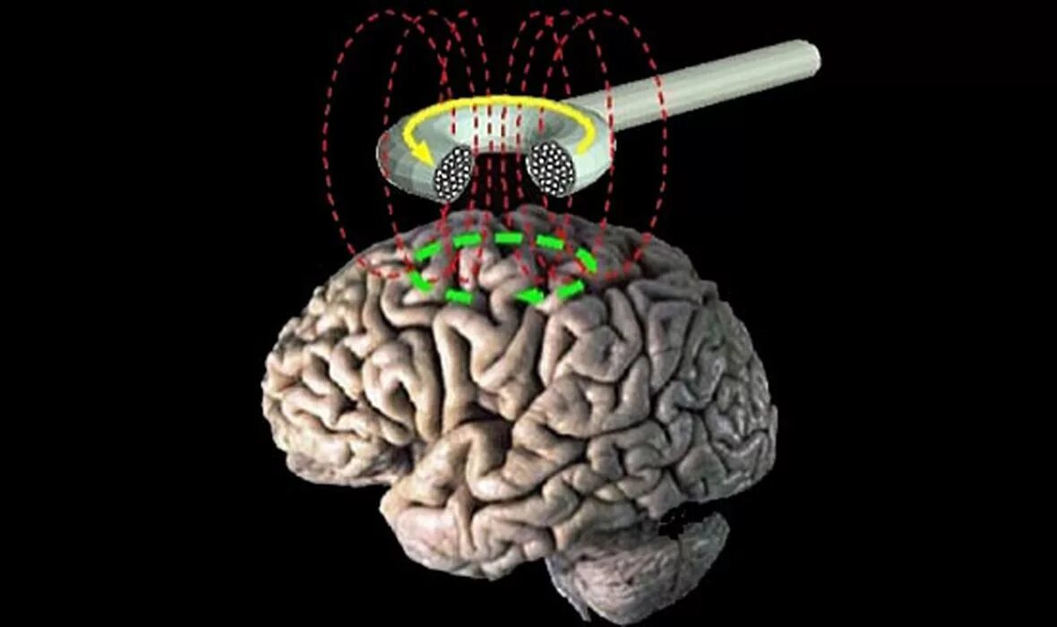 пища для улучшения памяти. еда для улушенияпамяти. питание мозга человека. еда для ума. для улучшения памяти и работы.