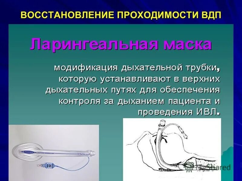 Какие мероприятия по восстановлению проходимости дыхательных путей. Восстановление проходимости верхних дыхательных путей. Восстановление проходимости ВДП. Методы восстановления проходимости верхних дыхательных путей. Приемы восстановления проходимости дыхательных путей.