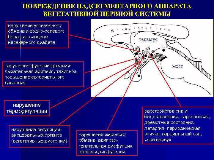 Вегетативные нарушения это. Синдром вегетативных расстройств симптомы. Надсегментарное расстройство вегетативной нервной системы. Дисфункция вегетативной системы. Нарушение функций вегетативной нервной системы.