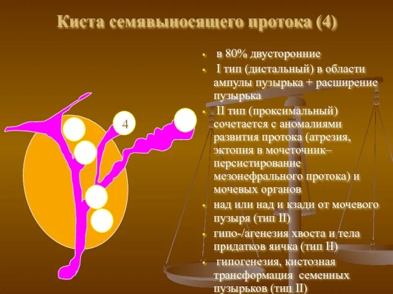 У мужчина киста будет. Киста маточки простаты. Кисты предстательной железы классификация. Киста семявыбрасывающего протока. Киста семявыносящего протока.