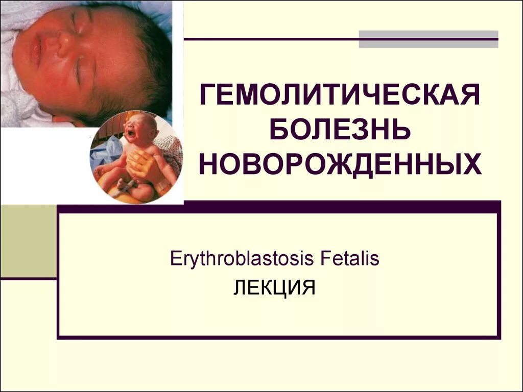 Болезнь грудных детей. Гемофильная болезнь новорожденных. гемолитическая болезнь новорожденных. болезнь гбн новорожденных. новорождённый ребёнок с гемолитической болезнью.