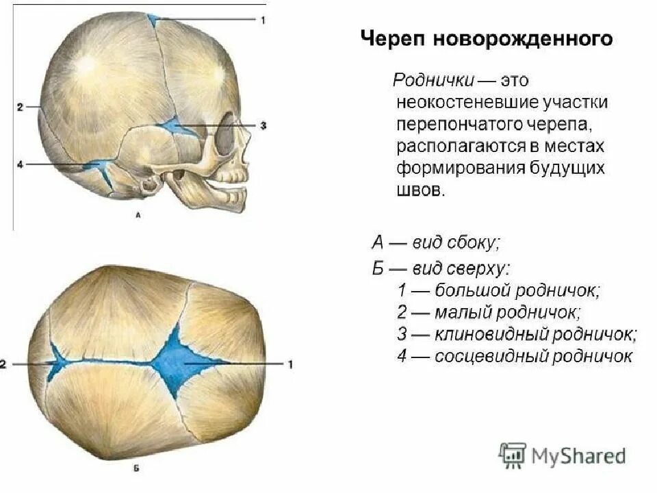 У ребенка 2 родничка. Расположение родничков у новорожденного. Роднички новорожденного анатомия черепа. Швы черепа вид сбоку. Швы и роднички черепа новорожденного.