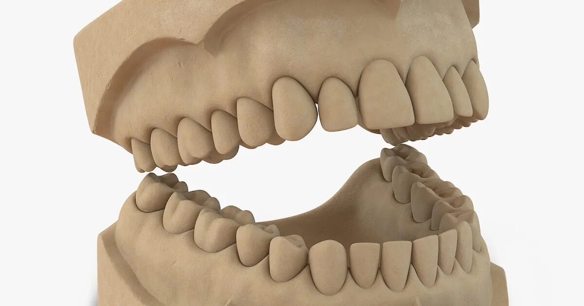 Модель зубов. Гипсовая модель в стоматологии. Макет зуба. Гипсовая модель.
