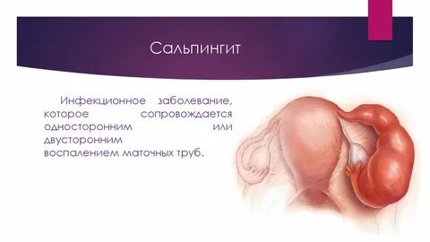 Острый гнойный двусторонний