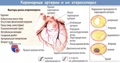 Проходимость артерий