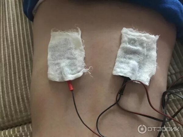 Чем можно заменить электрофорез в домашних условиях Лекарственный электрофорез тест