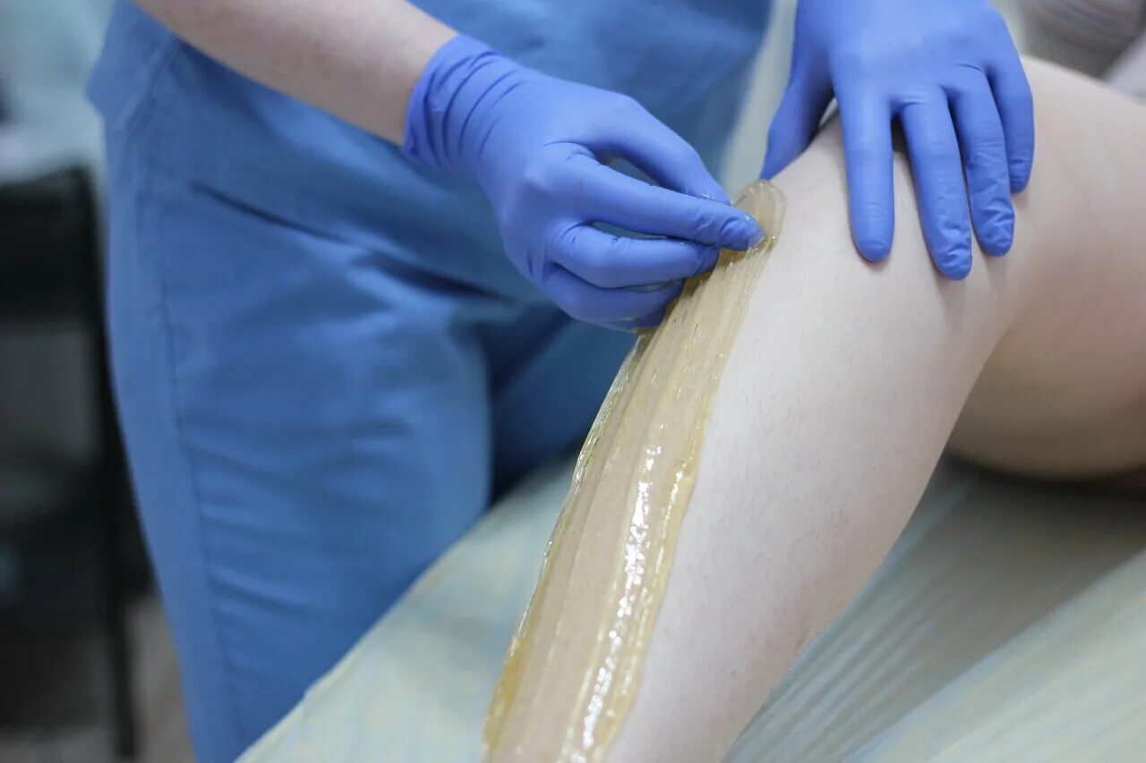 эпиляция мытищи