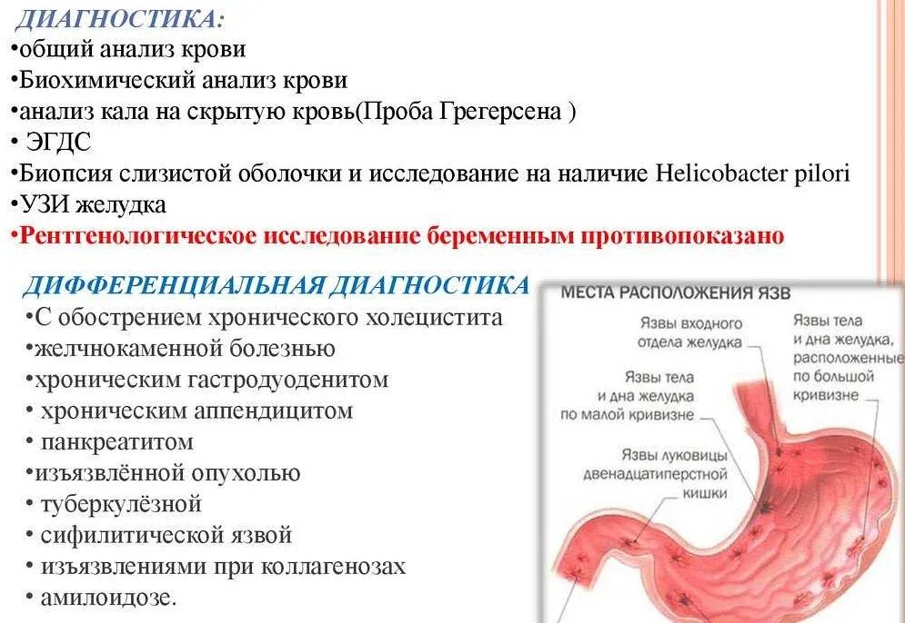 Какие боли при язве двенадцатиперстной. Лабораторные исследования при язвенной болезни желудка. обследование 12 язвенная болезнь желудка и 12-перстной кишки. клинический анализ крови при язвенной болезни 12 перстной кишки. анализ крови при язвенной болезни 12 перстной.
