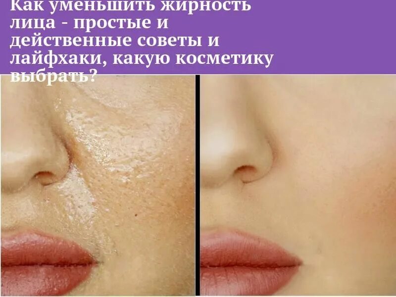 Как сделать кожу блестящей. Как сделать кожу блестящей