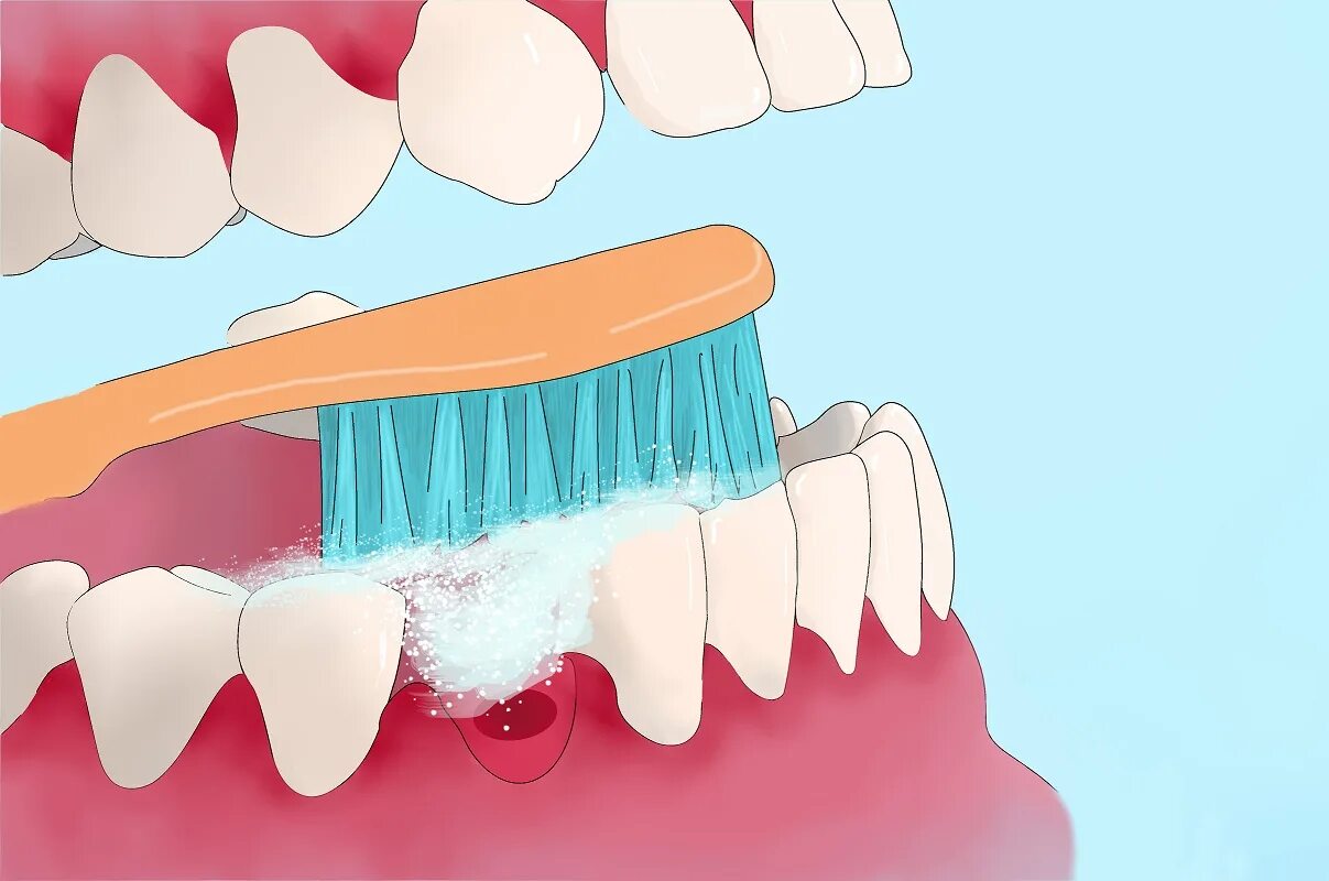 Гигиеническая чистка зубов щеткой. Чистка зубов пастой. Зуб паста. Антибактериальные зубы. Как чистить десна