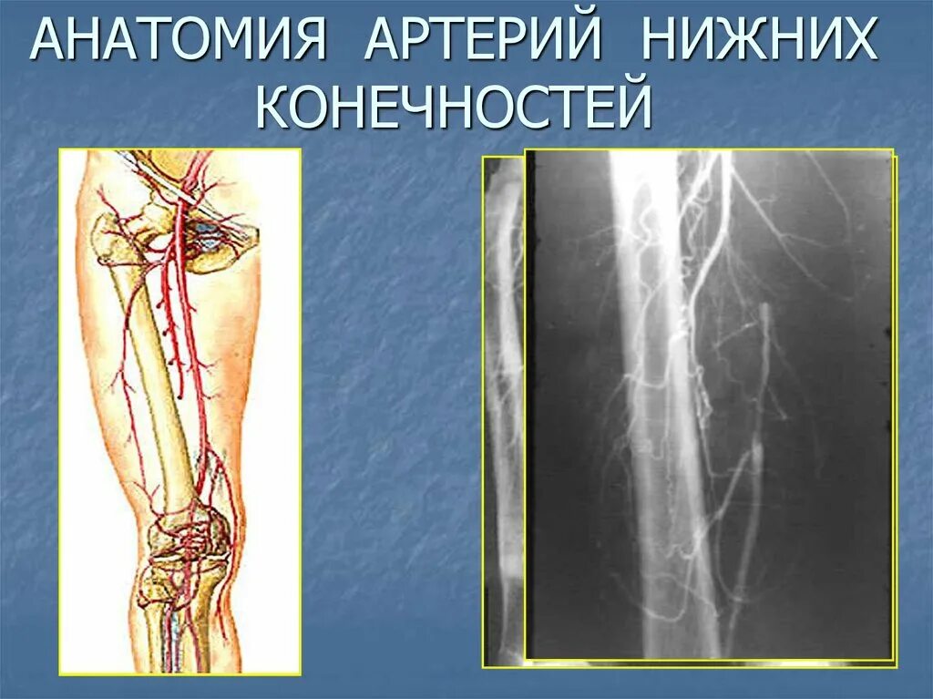 Артериальные сосуды нижних конечностей. Артерии нижней конечности анатомия. Сосуды нижних конечностей анатомия. Хирургическая анатомия артерий нижних конечностей. Заболевания артерий нижних конечностей.