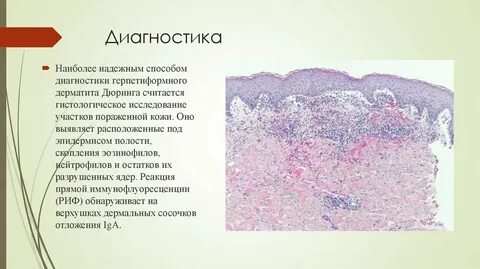 Тест на дерматит